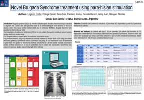 Poster HRS 2019 Vignette PDF