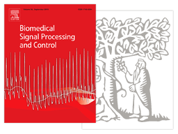 Depolarization spatial variance as a cardiac dyssynchrony descriptor Vignette de l'article sur le traitement et le contrôle des signaux biomédicaux