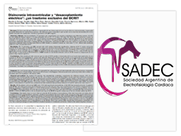 Disincronia intraventricular y desacoplamiento eléctrico Vignette de l'article de Sadec