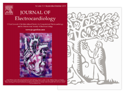 ECG parameters to predict left ventricular electrical delay Miniature de l'article du Journal de l'électrocardiologie