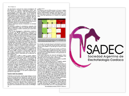 Nuevos conceptos en el tratamiento de la miocardiopatia hipertrofica Vignette de l'article de Sadec