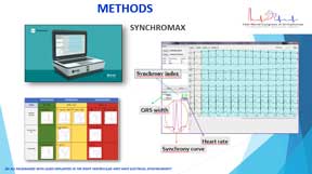 Synchromax-ORAL-WCA19-1167-retrospectivo-punta Miniature PowerPoint