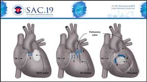 Synchromax Scaglione SAC 2019 Miniature PowerPoint