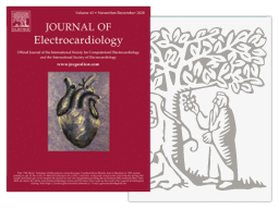 Novel-implant-technique-for-septal-pacing-ENG vignette du document à télécharger